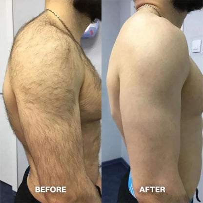 Hair Removal Cream for All Women & Men -up