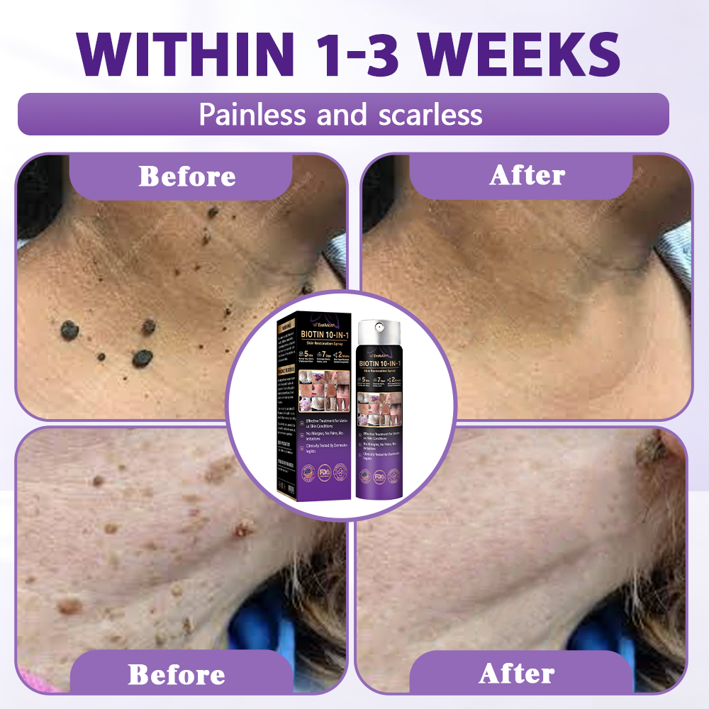 Made and Shipped from USA ✨Evolvion® Biotin 10-in-1 Skin Restoration Spray 🍀🍀