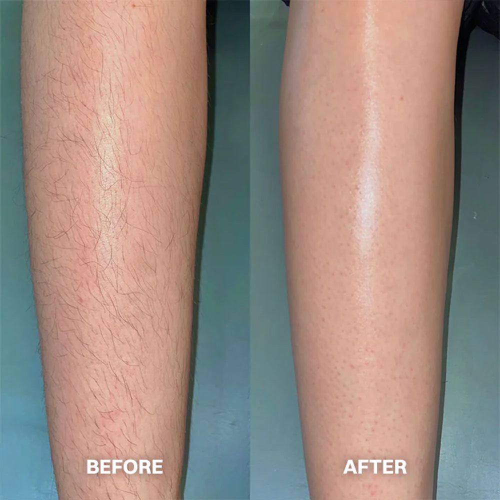 Hair Removal Cream for All Women & Men