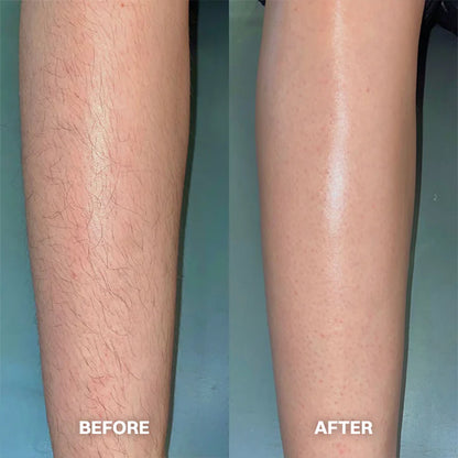 Hair Removal Cream for All Women & Men -up