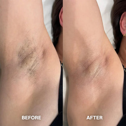 Hair Removal Cream for All Women & Men -up
