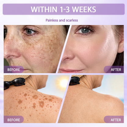 Rolimey® Anti-aging & Spot-repair Serum, Infused with 10% Niacinamide, Targets Sun Spots, Age Spots and Acne Marks, Advanced Melanin Blocking Formula