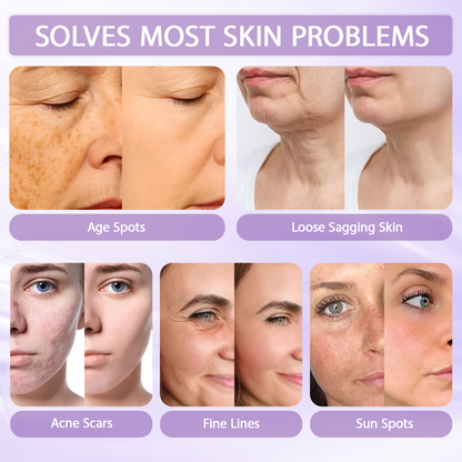 Rolimey® Anti-aging & Spot-repair Serum, Infused with 10% Niacinamide, Targets Sun Spots, Age Spots and Acne Marks, Advanced Melanin Blocking Formula