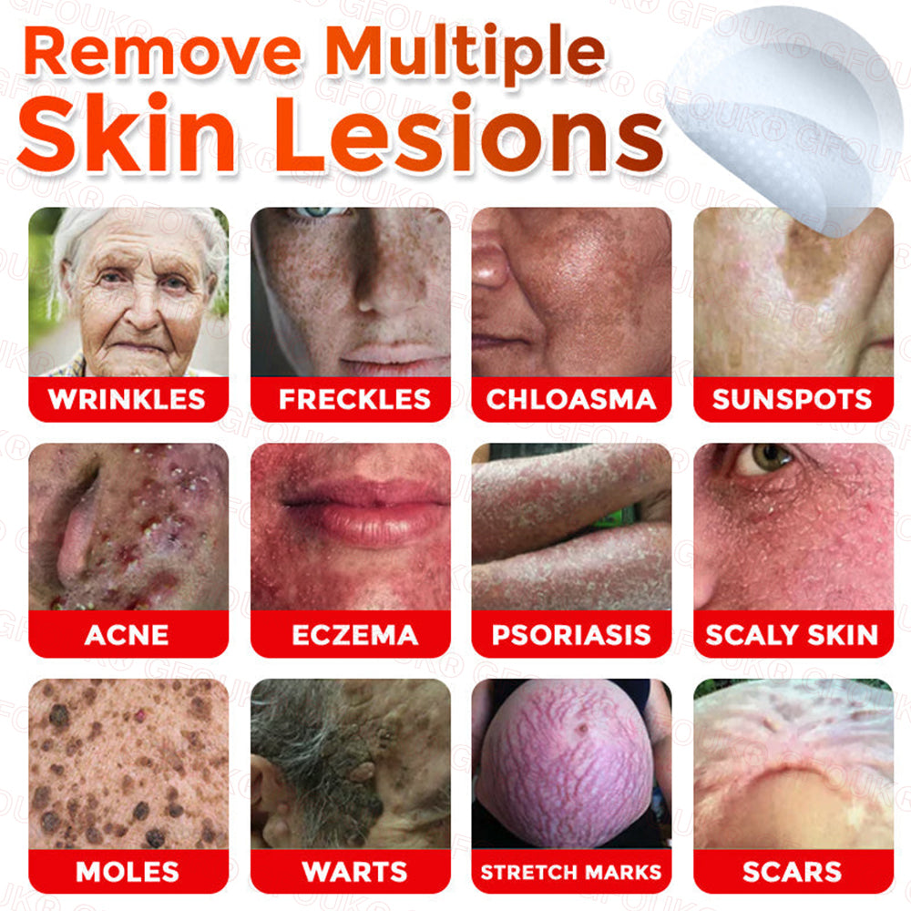 GFOUK® Soluble Microneedle Botanical Skin Tag Removal Patch🌷