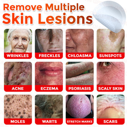 GFOUK® Soluble Microneedle Botanical Skin Tag Removal Patch🌷