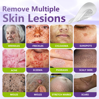 GFOUK® Soluble Microneedle Botanical Skin Tag Removal Patch🍀🍀