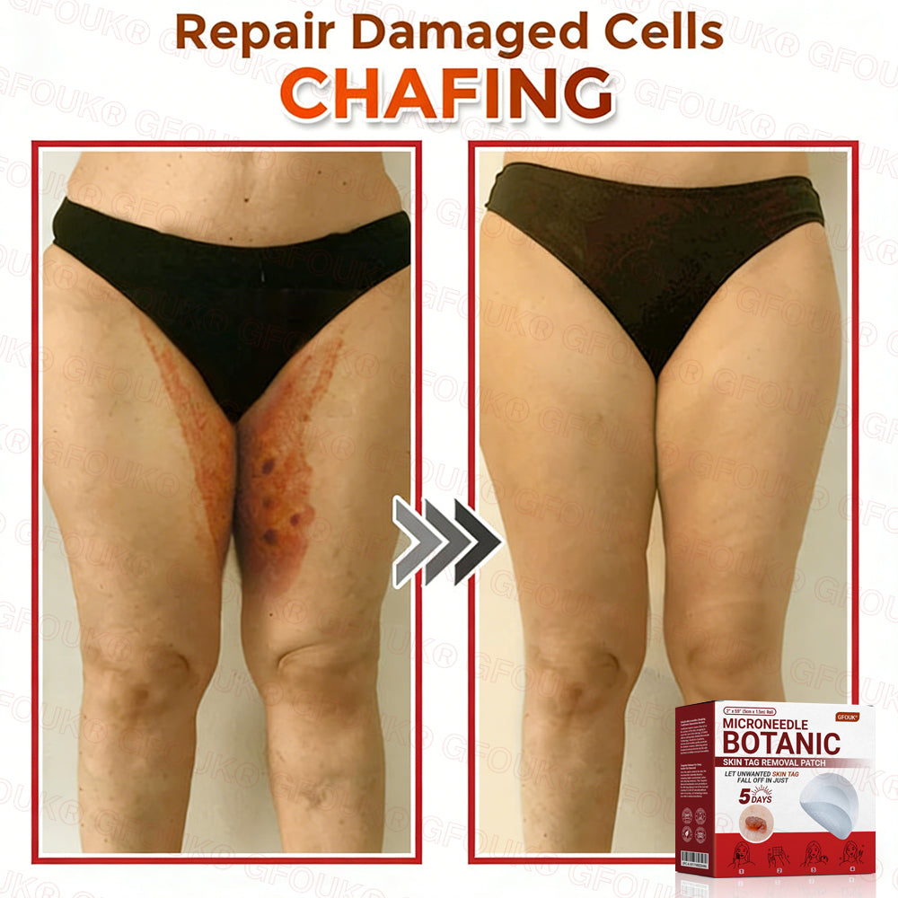GFOUK® Soluble Microneedle Botanical Skin Tag Removal Patch🌷
