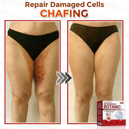 GFOUK® Soluble Microneedle Botanical Skin Tag Removal Patch🌷
