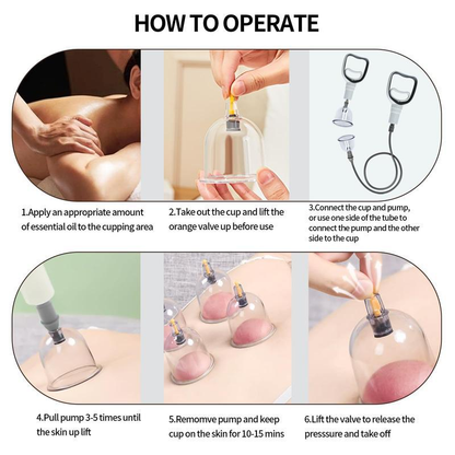 Tinycarry® Cupping Set, 6 Cups Cupping Kit for Massage Therapy, Chinese Cupping Therapy Set with Magnetics, Professional Vacuum Cupping Set for Cellulite Reduction Muscle Pain Relief with Manual Pump