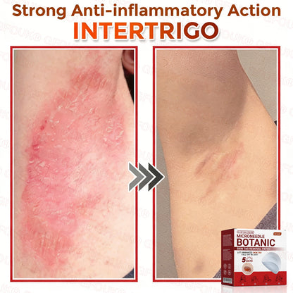 GFOUK® Soluble Microneedle Botanical Skin Tag Removal Patch🌷