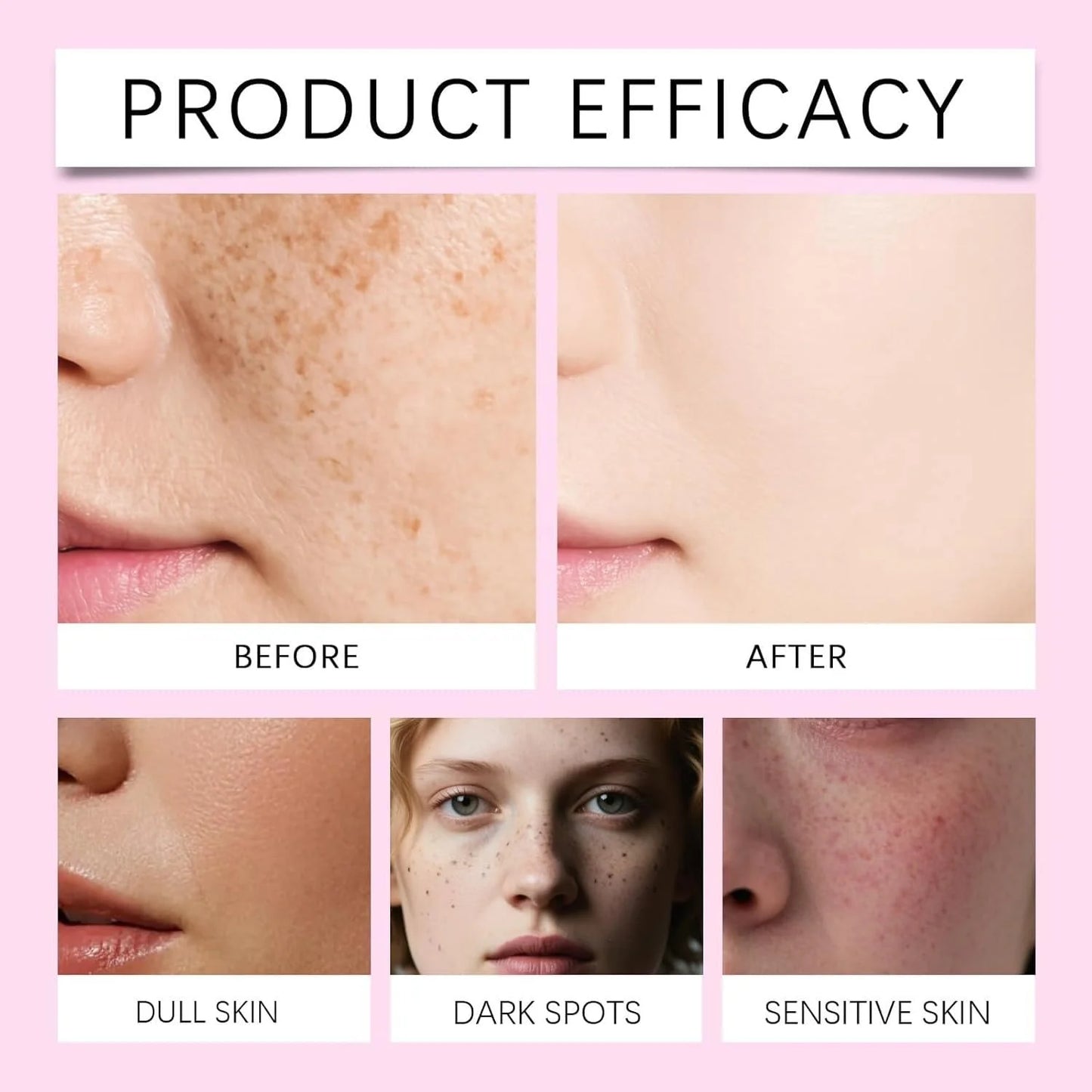 ✨ Tranexamic Acid Brightening Cream